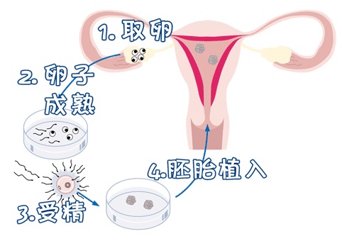 中国供卵代孕中心